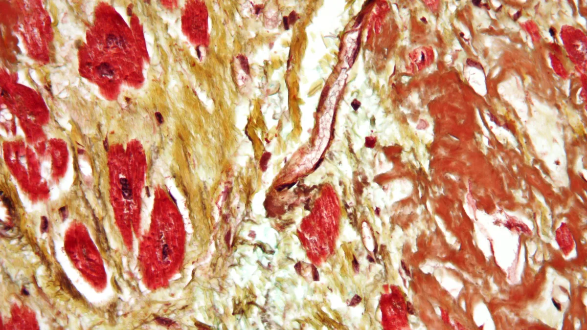 Cardiovascular