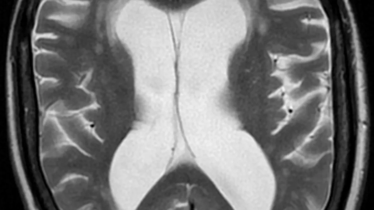 Neurology and dementia